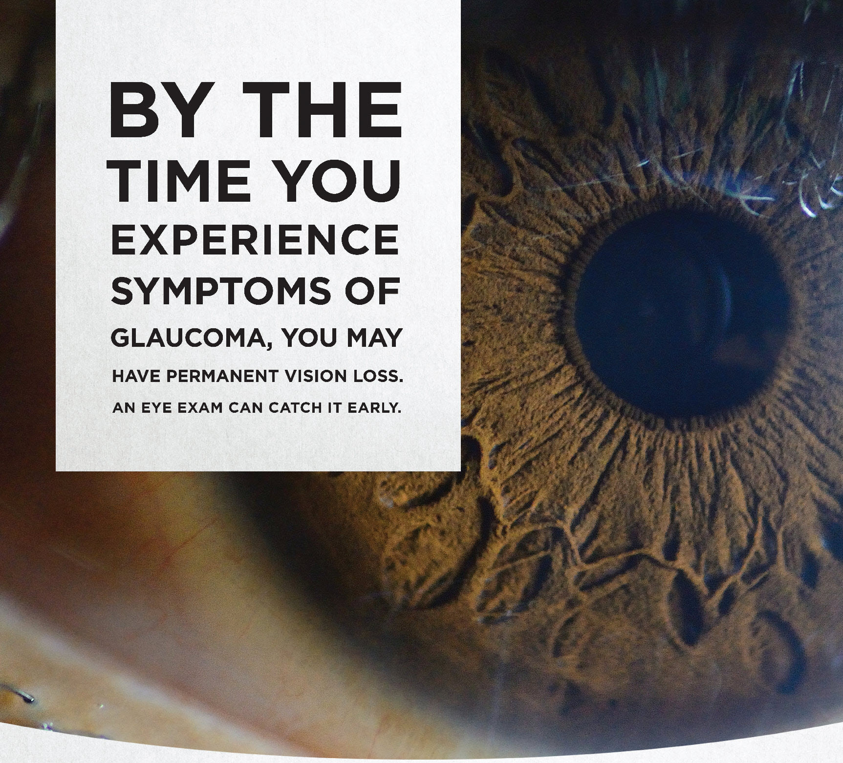 glaucoma-albuquerque-glaucoma-symptoms-santa-fe-eye-nm